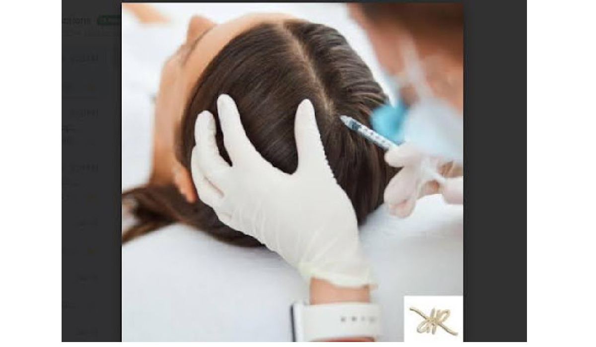 Best Hair Loss Treatments in Dubai by Roxana Aesthetics